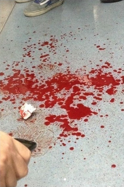 北京地铁10号线爆恶意刺伤事件 女子脸部划伤